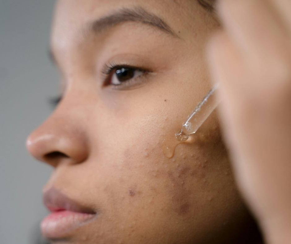 Unlocking the Benefits of Retinol for Diverse Skin Tones